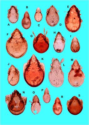 Small Human Population Drastic Impact, as Inferred From Multi-Proxies of a Temporary Carpathian Lake